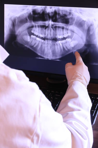 Best Emergency Wisdom Teeth Removal in Grill, PA